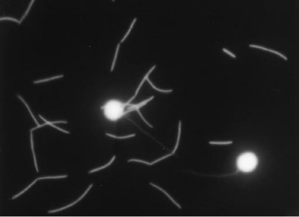 Bacteria clumped together into strings